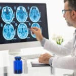 Brain Injury Compensation